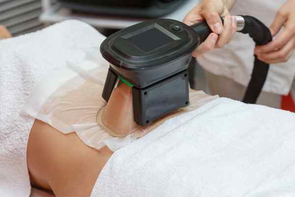 Areas of the Body we treat Cryolipolysis Westcliff-on-Sea