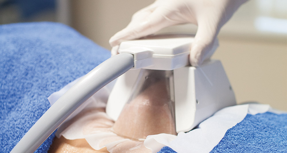 How Fat Freezing and HIFU Work Together? 2 Multiple Areas in One Session HIFU and Fat Freezing Westcliff-on-Sea