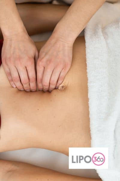 diastasis recti treatment Westcliff-on-Sea