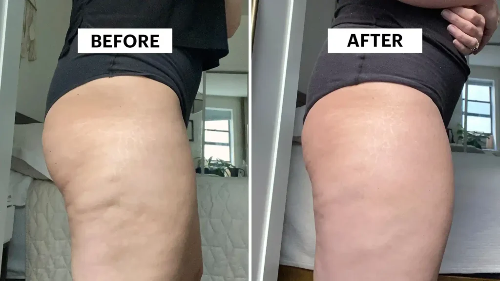 Do Toning Exercise Westcliff-on-Sea Really Tackle Cellulite?