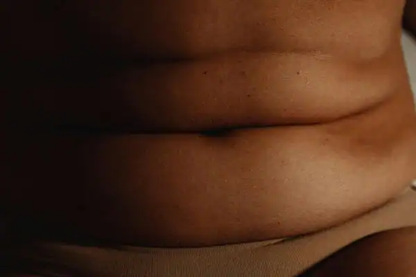 The Hidden Connection: How Stress Shapes Your Fitness and Body Composition 3 image of what stress can do on the stomach area and how Lipo 360 Westcliff-on-Sea can help to change your body shape.
